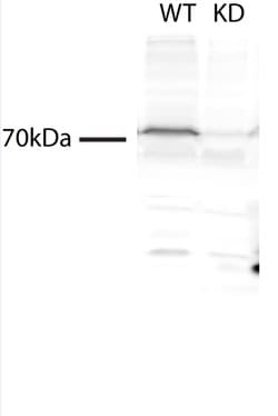 TMEM214 Rabbit anti-Human, Mouse, Rat, Polyclonal, Proteintech 150 &mu;L;