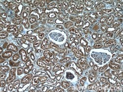 CXorf26 Rabbit anti-Human, Mouse, Polyclonal, Proteintech 150 &mu;L; Unconjugated:Antibodies,