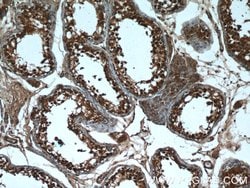 CXorf26 Rabbit anti-Human, Mouse, Polyclonal, Proteintech 150 &mu;L; Unconjugated:Antibodies,