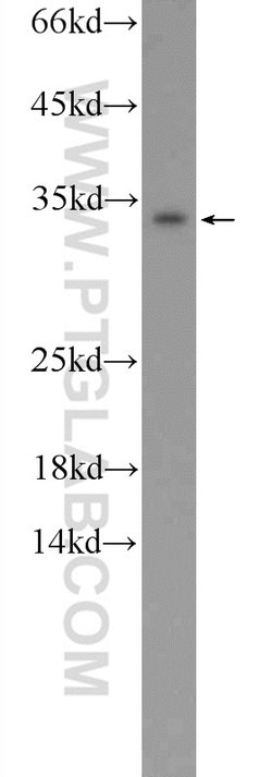 CXorf26 Rabbit anti-Human, Mouse, Polyclonal, Proteintech 150 &mu;L; Unconjugated:Antibodies,