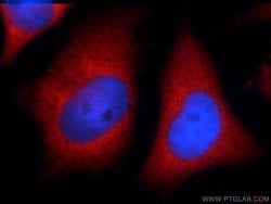 CXorf26 Rabbit anti-Human, Mouse, Polyclonal, Proteintech 150 &mu;L; Unconjugated:Antibodies,