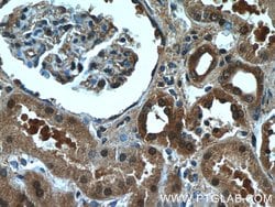 CXorf26 Rabbit anti-Human, Mouse, Polyclonal, Proteintech 150 &mu;L; Unconjugated:Antibodies,