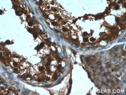 CXorf26 Rabbit anti-Human, Mouse, Polyclonal, Proteintech