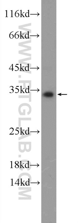CXorf26 Rabbit anti-Human, Mouse, Polyclonal, Proteintech 150 &mu;L; Unconjugated:Antibodies,