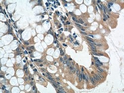 GPR81 Rabbit anti-Human, Polyclonal, Proteintech 20 &mu;L; Unconjugated:Antibodies,