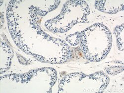 MARK4 Rabbit anti-Human, Mouse, Rat, Polyclonal, Proteintech 150 &mu;L;