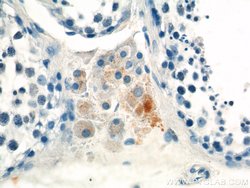 MARK4 Rabbit anti-Human, Mouse, Rat, Polyclonal, Proteintech 150 &mu;L;