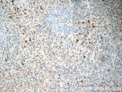 MARK4 Rabbit anti-Human, Mouse, Rat, Polyclonal, Proteintech 150 &mu;L;
