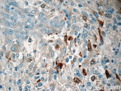 MARK4 Rabbit anti-Human, Mouse, Rat, Polyclonal, Proteintech 150 &mu;L;
