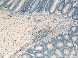 MARK4 Rabbit anti-Human, Mouse, Rat, Polyclonal, Proteintech 150 &mu;L;