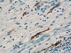 MARK4 Rabbit anti-Human, Mouse, Rat, Polyclonal, Proteintech 150 &mu;L;