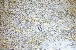 MARK4 Rabbit anti-Human, Mouse, Rat, Polyclonal, Proteintech