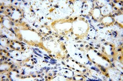 MARK4 Rabbit anti-Human, Mouse, Rat, Polyclonal, Proteintech 150 &mu;L;