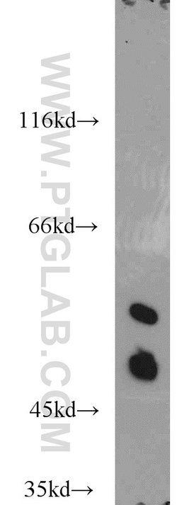 MARK4 Rabbit anti-Human, Mouse, Rat, Polyclonal, Proteintech 150 &mu;L;