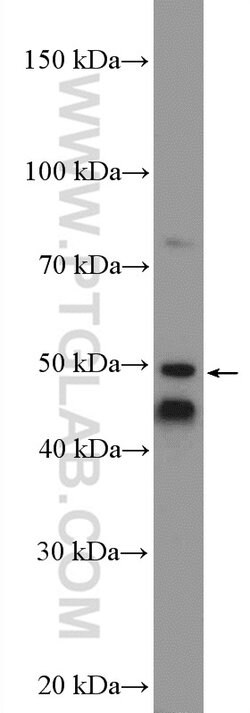 MARK4 Rabbit anti-Human, Mouse, Rat, Polyclonal, Proteintech 150 &mu;L;