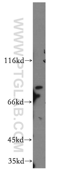 MARK4 Rabbit anti-Human, Mouse, Rat, Polyclonal, Proteintech 150 &mu;L;