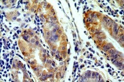 GPR105 Rabbit anti-Human, Mouse, Rat, Polyclonal, Proteintech 150 &mu;L;