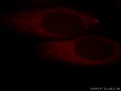 POTEA Rabbit anti-Human, Polyclonal, Proteintech:Antibodies:Primary Antibodies