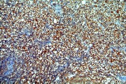 POTEA Rabbit anti-Human, Polyclonal, Proteintech:Antibodies:Primary Antibodies