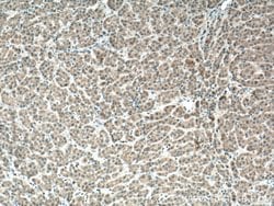 IGF1B Rabbit anti-Human, Polyclonal, Proteintech:Antibodies:Primary Antibodies