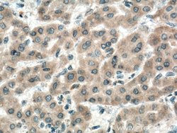 IGF1B Rabbit anti-Human, Polyclonal, Proteintech:Antibodies:Primary Antibodies