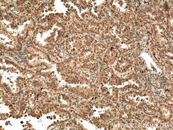 IGF1B Rabbit anti-Human, Polyclonal, Proteintech:Antibodies:Primary Antibodies
