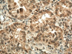 IGF1B Rabbit anti-Human, Polyclonal, Proteintech:Antibodies:Primary Antibodies