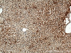 IGF1B Rabbit anti-Human, Polyclonal, Proteintech:Antibodies:Primary Antibodies