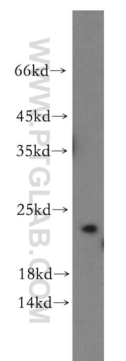 IGF1B Rabbit anti-Human, Polyclonal, Proteintech:Antibodies:Primary Antibodies