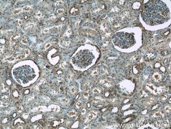 ARF6 Rabbit anti-Human, Mouse, Polyclonal, Proteintech 150 &mu;L; Unconjugated:Antibodies,