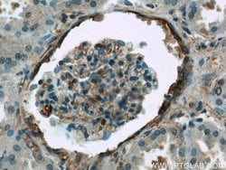 ARF6 Rabbit anti-Human, Mouse, Polyclonal, Proteintech 150 &mu;L; Unconjugated:Antibodies,
