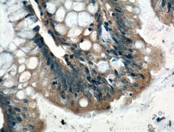 ARF6 Rabbit anti-Human, Mouse, Polyclonal, Proteintech 150 &mu;L; Unconjugated:Antibodies,