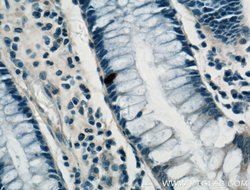 ARF6 Rabbit anti-Human, Mouse, Polyclonal, Proteintech 150 &mu;L; Unconjugated:Antibodies,