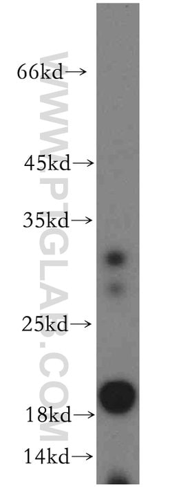 ARF6 Rabbit anti-Human, Mouse, Polyclonal, Proteintech 150 &mu;L; Unconjugated:Antibodies,