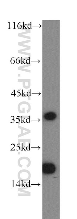 ARF5 Rabbit anti-Human, Mouse, Rat, Polyclonal, Proteintech:Antibodies:Primary