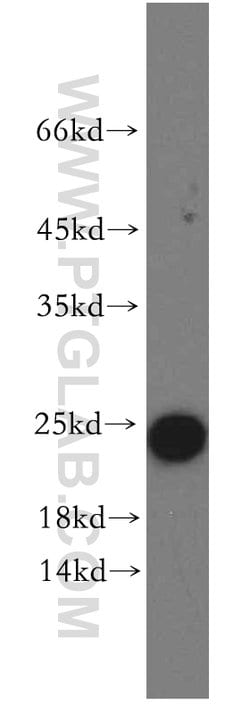 ARF5 Rabbit anti-Human, Mouse, Rat, Polyclonal, Proteintech:Antibodies:Primary