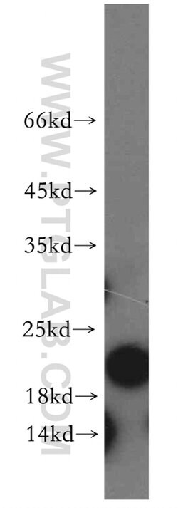 ARF5 Rabbit anti-Human, Mouse, Rat, Polyclonal, Proteintech:Antibodies:Primary