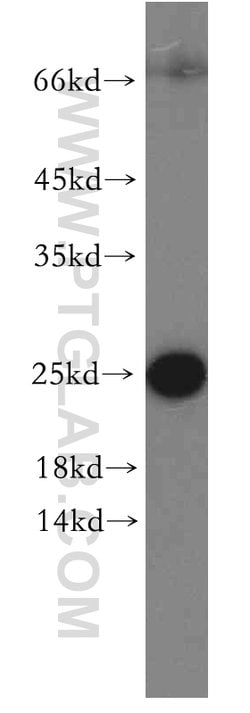ARF5 Rabbit anti-Human, Mouse, Rat, Polyclonal, Proteintech:Antibodies:Primary