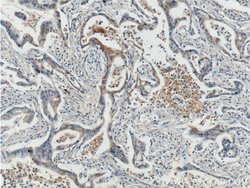 ADAM17 Rabbit anti-Human, Polyclonal, Proteintech 20 &mu;L; Unconjugated:Antibodies,