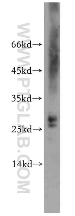 PPP1R11 Rabbit anti-Human, Mouse, Polyclonal, Proteintech 150 &mu;L; Unconjugated:Antibodies,