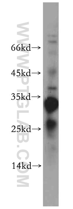 PPP1R11 Rabbit anti-Human, Mouse, Polyclonal, Proteintech 150 &mu;L; Unconjugated:Antibodies,