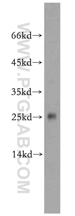 PPP1R11 Rabbit anti-Human, Mouse, Polyclonal, Proteintech 150 &mu;L; Unconjugated:Antibodies,