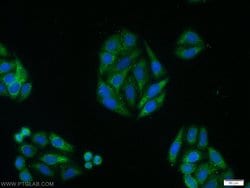LATS2 Rabbit anti-Human, Mouse, Polyclonal, Proteintech:Antibodies:Primary