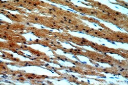 LATS2 Rabbit anti-Human, Mouse, Polyclonal, Proteintech:Antibodies:Primary