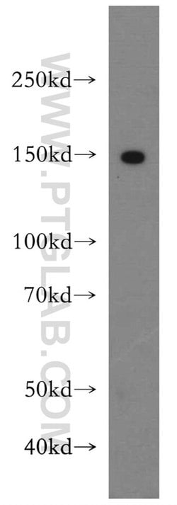 LATS2 Rabbit anti-Human, Mouse, Polyclonal, Proteintech:Antibodies:Primary