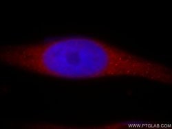 RADIL Rabbit anti-Human, Polyclonal, Proteintech:Antibodies:Primary Antibodies