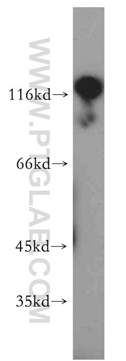 RADIL Rabbit anti-Human, Polyclonal, Proteintech:Antibodies:Primary Antibodies