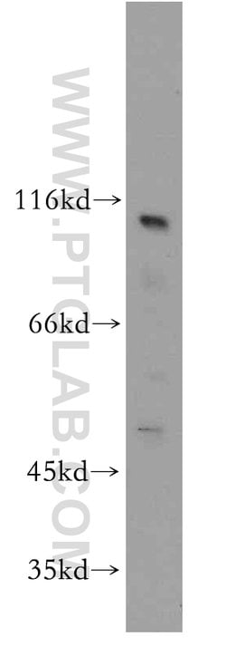 RADIL Rabbit anti-Human, Polyclonal, Proteintech:Antibodies:Primary Antibodies