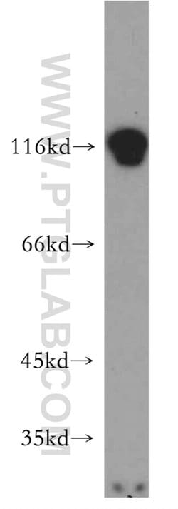 RADIL Rabbit anti-Human, Polyclonal, Proteintech:Antibodies:Primary Antibodies
