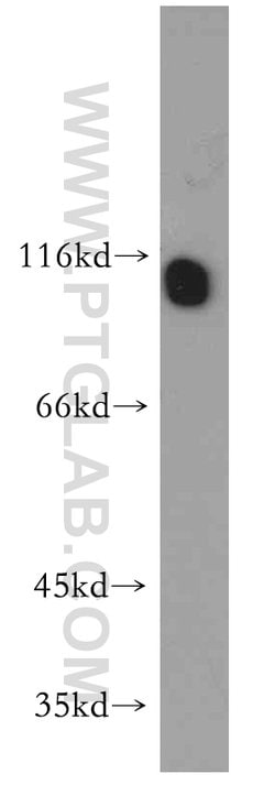 RADIL Rabbit anti-Human, Polyclonal, Proteintech:Antibodies:Primary Antibodies